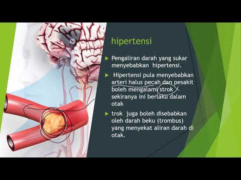 BIOLOGI TINGKATAN 4 : 10.6 ISU KESIHATAN BERKAITAN SISTEM PEREDARAN MANUSIA