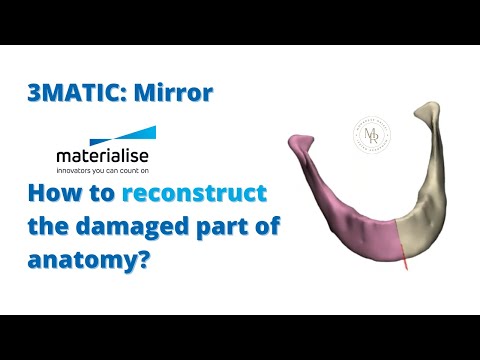 3matic : mirror - how to make symmetrical correction | تری متیک- اصلاحات تقارنی