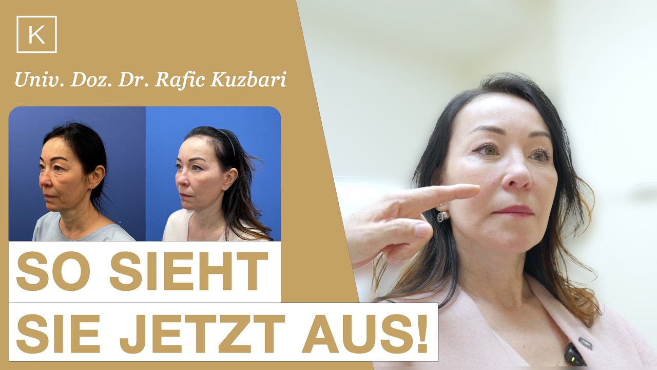 Vorschau: 6 Monate nach dem Facelift