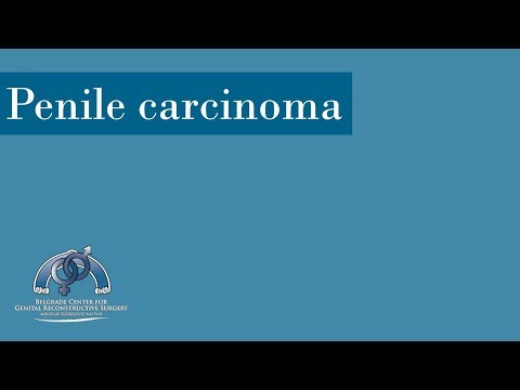 Penile Carcinoma: Complete Penile Reconstruction