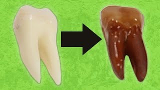 What Happens When You Put Teeth In Soda
