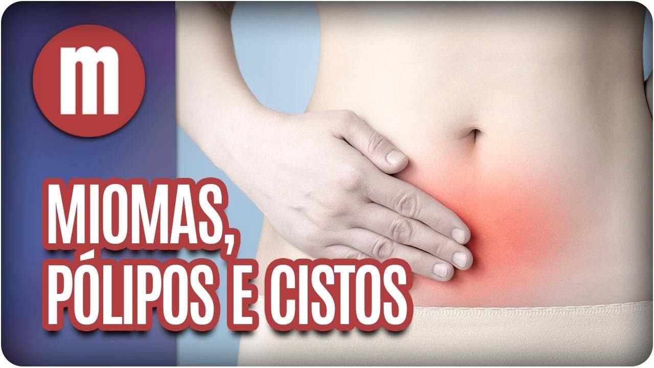 Miomas, Pólipos e Cistos - Mulheres (29/06/17)