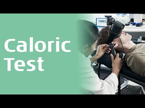 Caloric Test: Testing and Analysis