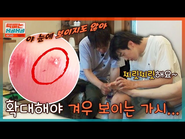 엄살왕 강훈, 눈에 보이지도 않는 가시에 비명 작렬 | 택배는 몽골몽골 …