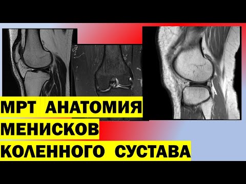 Боль в спине из за неправильной осанки Какая мазь эффективна при сильной боли в спине