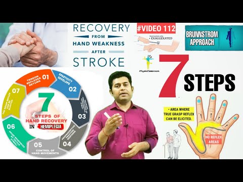 AN INTRODUCTION TO BRUNNSTROM APPROACH MOVEMENT THERAPY IN HEMIPLEGIA