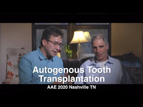 Autogenna transplantacja zęba
