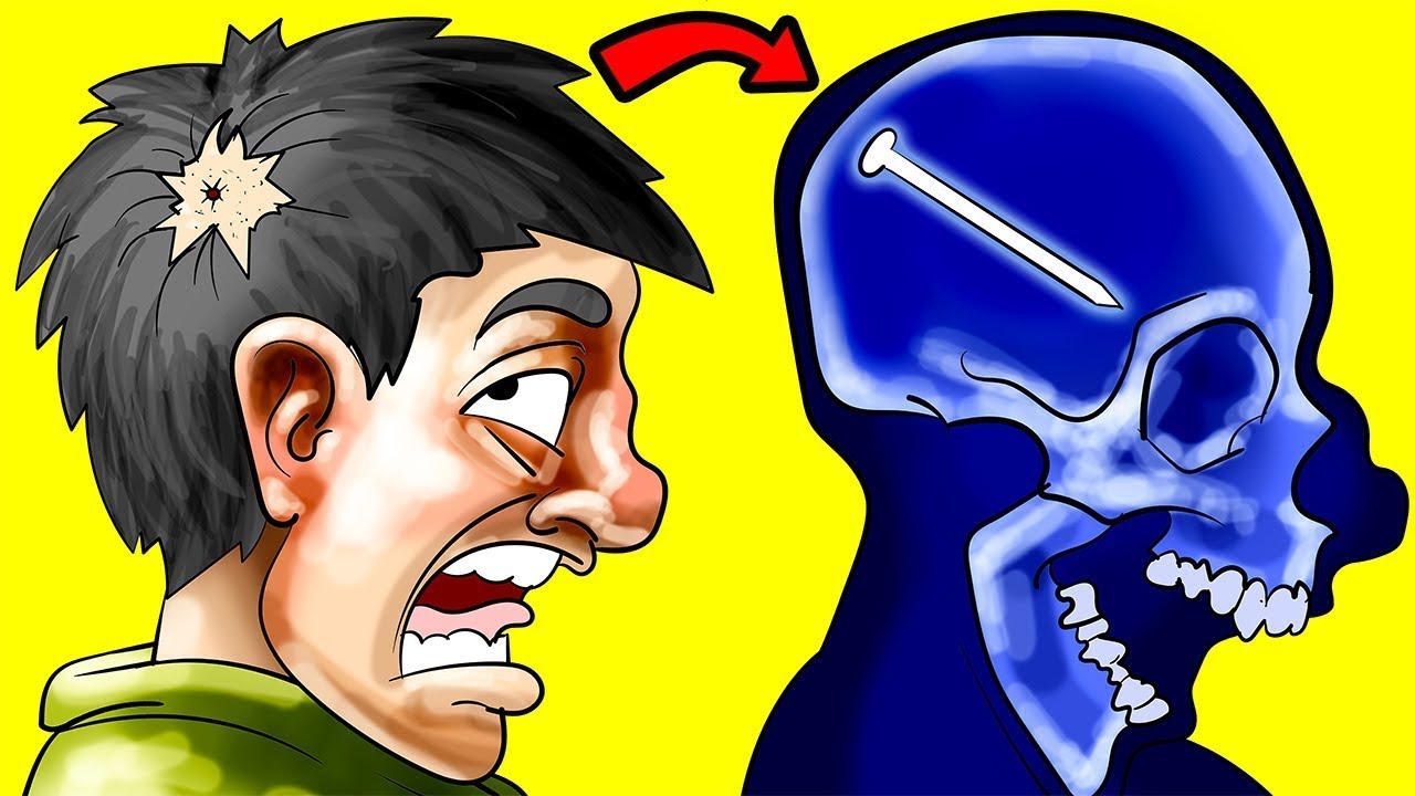 Personas Suertudas Que Sobrevivieron Lo IMPOSIBLE - Parte 9