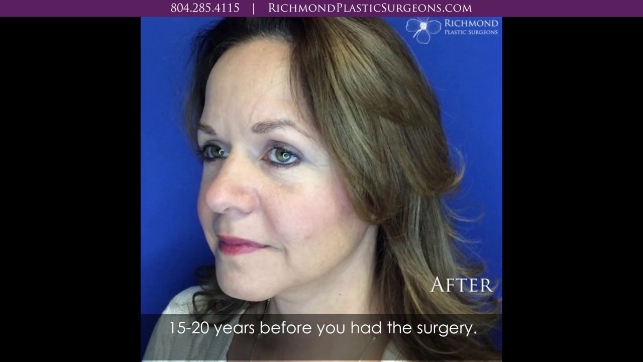 Richmond Plastic Surgeons