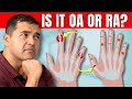 Osteoarthritis Or RA Spot The Difference In Your Hands