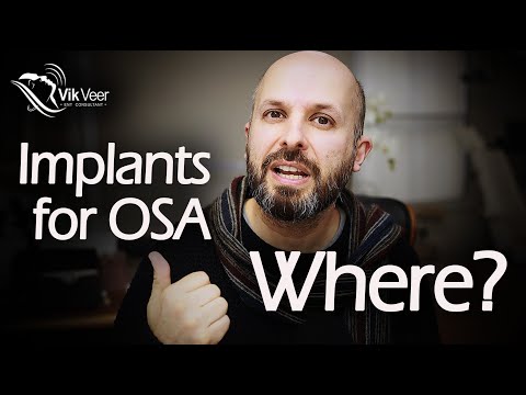 Inspire/Genio Implants for Sleep Apnoea