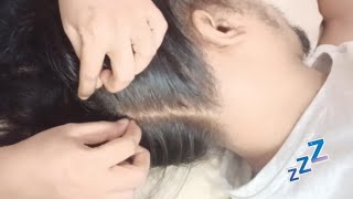 ASMR🌟 ✨ Scalp Check Tingles & Treatment (Real Person) ,Deep Sleep 😴😴#sleep #asmr #relax