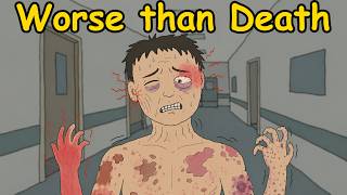 What's the Worst Diseases to have?