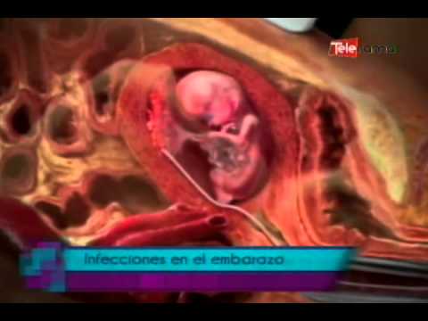 Como eliminar oxiuros en el embarazo Oxiuros en mujeres embarazadas