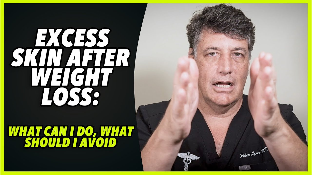 Ep:190 EXCESS SKIN AFTER WEIGHT LOSS: WHAT CAN I DO, WHAT SHOULD I AVOID - by Robert Cywes