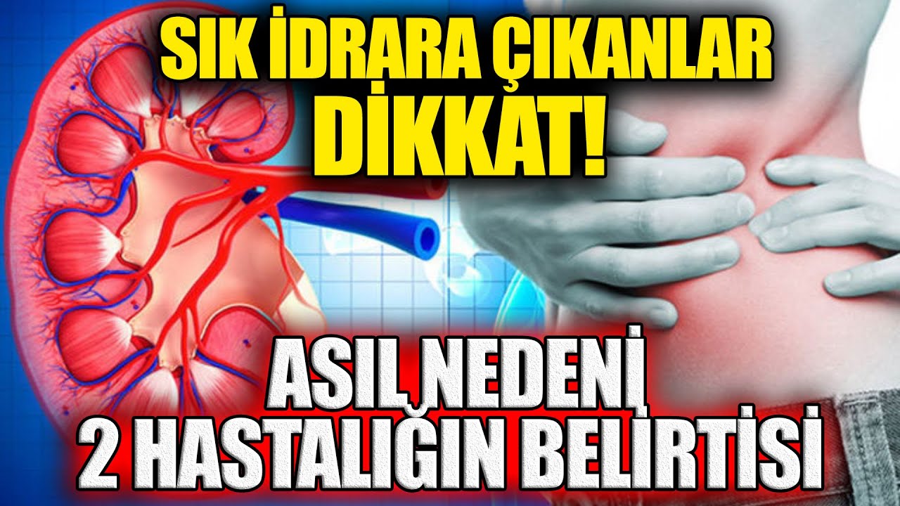 Sık İdrara Çıkanlar Dikkat! Asıl Nedeni 2 hastalığın Belirtisi!