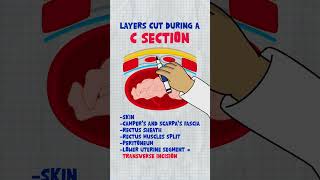 Download lagu Operasi Caesar Darurat Dijelaskan dalam 60 detik | Langkah 2 OB-GYN Mnemonik Bermanfaat Tinggi mp3