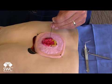 Suture- Figure of 8 Hemostatic