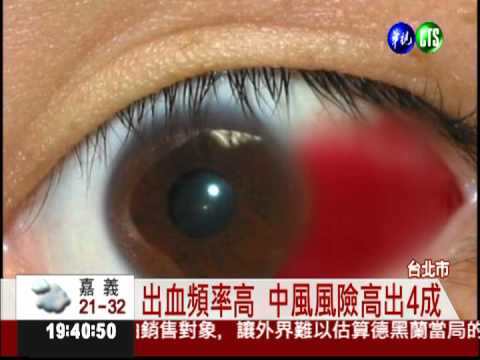 眼結膜常出血 中風機率高!