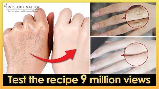 How to make your hands look younger, smoot, fair overnight!  (Test the recipe 9 million views)