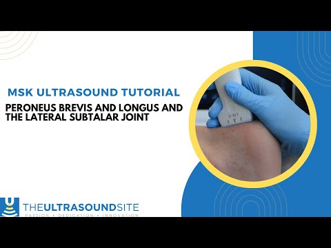 Musculoskeletal ultrasound of Peroneus longus and Peroneus brevis and the lateral subtalar joint.