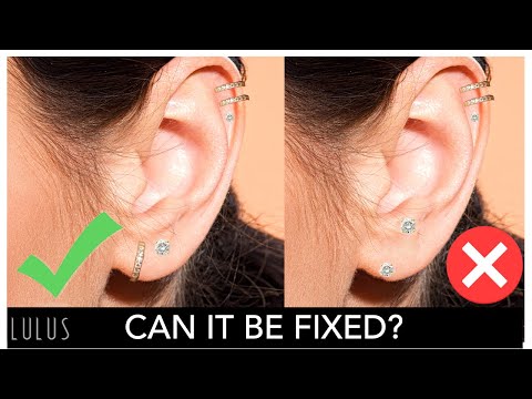Miért fáj a fül fülbevalók után, és hogyan lehet kezelni a vizeletgyulladást??