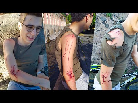 Ho preso il muro a 60km/h in bici.