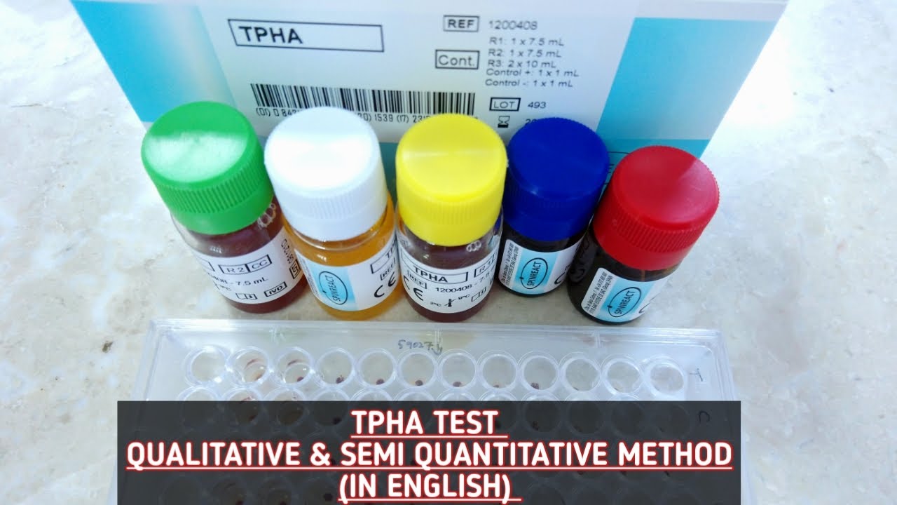 Watch Now TPHA test.Qualitative & Semi Quantitative method.Step by step explanation. Result interpretation. TPHA test.Qualitative & Semi Quantitative method.Step by step explanation. Result interpretation.