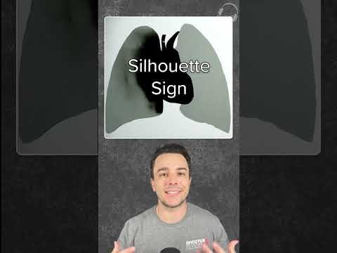 Silhouette Sign in Chest X-Rays