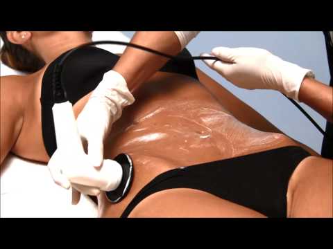 Silicone singsing para sa pagbaba ng timbang kung paano magsuot ng litrato Slimming Belt simpleng