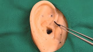 👂귀에 박힌 돌 제거하기 2｜상황극(Sub ✔)｜이비인후과 ASMR｜시청각 팅글 폭발