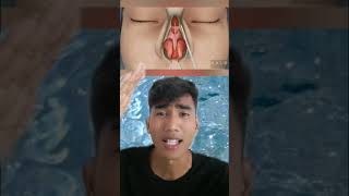Download lagu Begini proses operasi hidung mancung mp3 Download lagu Begini proses operasi hidung mancung mp3
