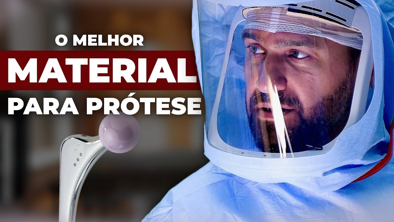 😱 Qual melhor material da Prótese de Quadril? | Dr. David Gusmão