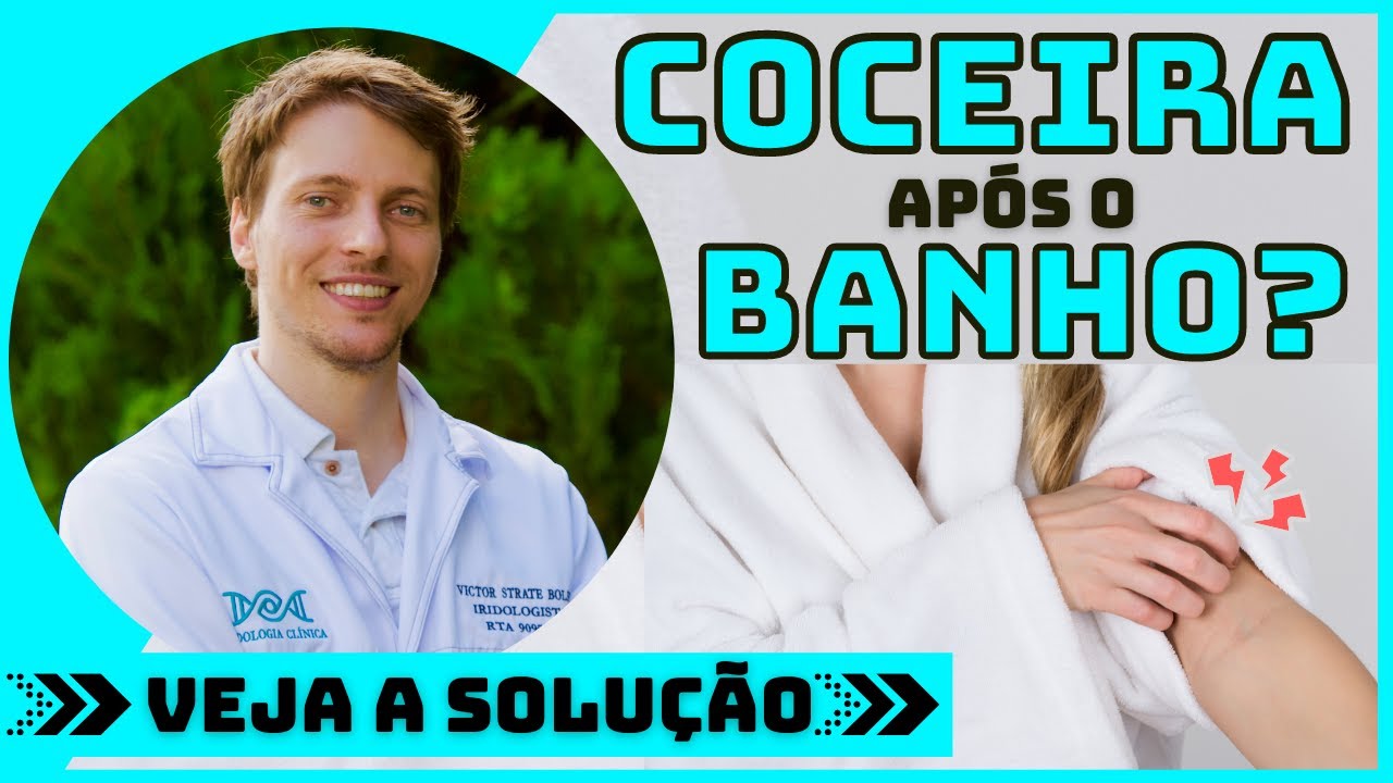 COCEIRA APÓS O BANHO🚿 - Você fica se coçando depois do banho VEJA UMA SOLUÇÃO.