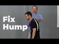 Dowager S Hump Exercises AKA Hyperkyphosis