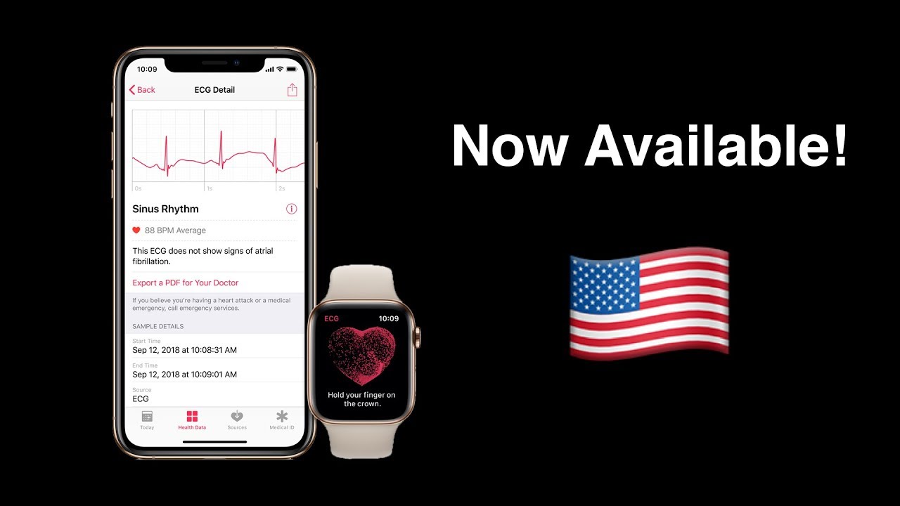 watchOS 5.1.2 Released! ECG Now Available, But Bad News...