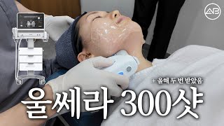⚠️울쎄라 300샷 리얼 후기⚠️