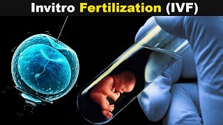 How Test Tube Babies Are produced? | Invitro Fertilization (Urdu/Hindi)