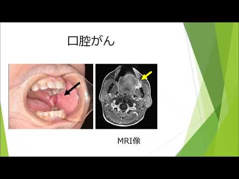 【山口大学OC2025／医学部／医学科】歯科口腔外科学講座紹介