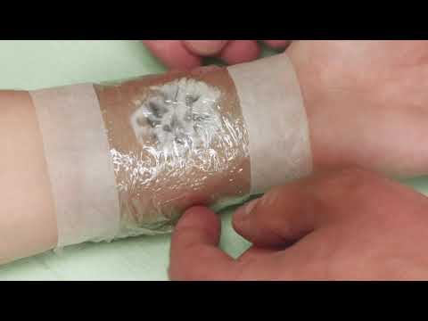 Zensa Application | Laser Tattoo Removal | Unthink Inc.