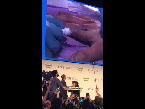 MWC19 | Live Chip Implant on Stage at 4YFN [2019]