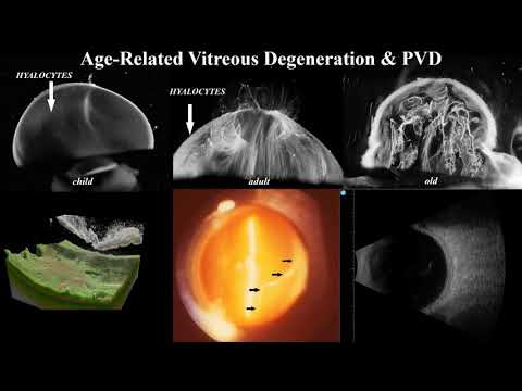 EURETINA (European Society of Retinal Specialists founded in 2000)