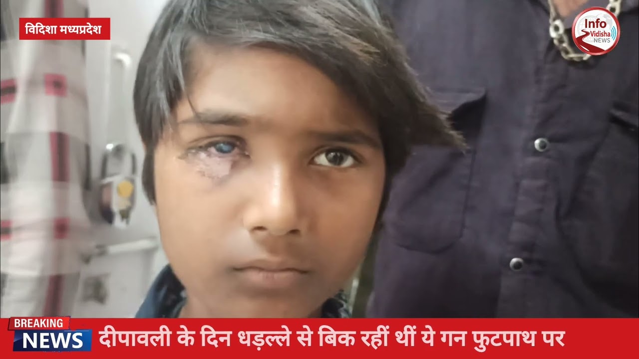 रोशनी के त्यौहार पर लापरवाही से गई दर्जनों लोगों की आँखें ,पुलिस ने 5 को पकड़ा......