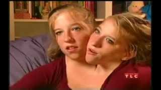 Abby brittany hensel. Conjoined twins. (Abigail Brittany Hensel) turn 16. Twins Who Share a Body
