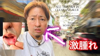 【微グロ】異国の歯医者に行った結果…【閲注】