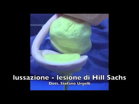 Il trattamento della scoliosi della colonna cervicale Mal di schiena a 17 settimane di gestazione