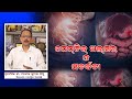 Peptic Ulcer Disease/Causes/Symptoms/Diagnosis/Treatment/Prof Dr Manoj Kumar Sahu /Tips /