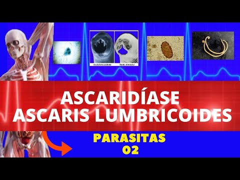 ASCARIDÍASE - ASCARIS LUMBRICOIDES (LOMBRIGA) - PARASITOLOGIA | INFECTOLOGIA