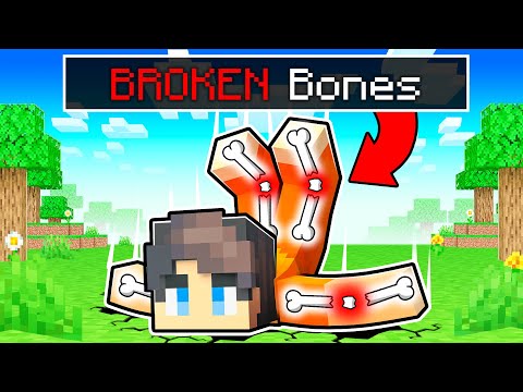 Pretending I BROKE MY BONES in Minecraft