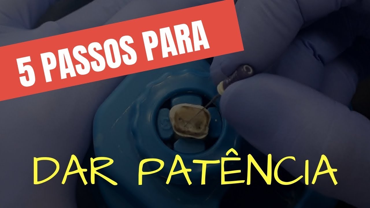 OS 5 PASSOS PARA DAR PATÊNCIA EM CASOS DIFÍCEIS - QUICK TIP ENDOLOVERS